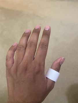 A white paper ring on the thumb of the back of a left hand.